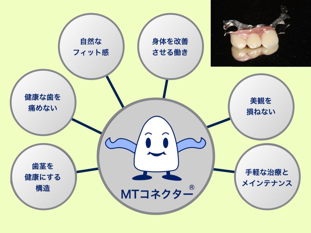 MTコネクターの説明